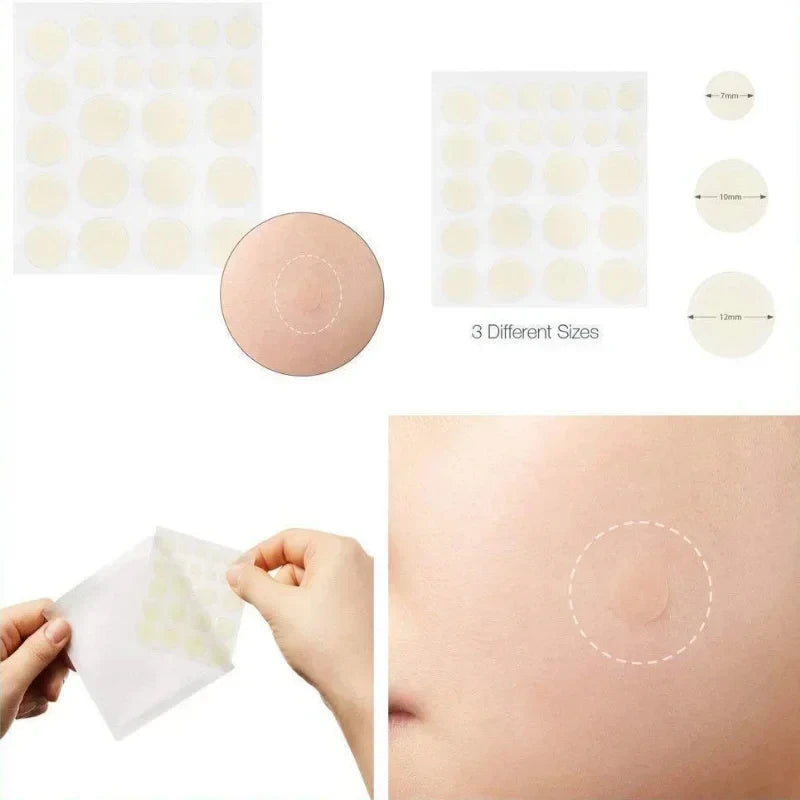 Overnight Acne Healing Patches