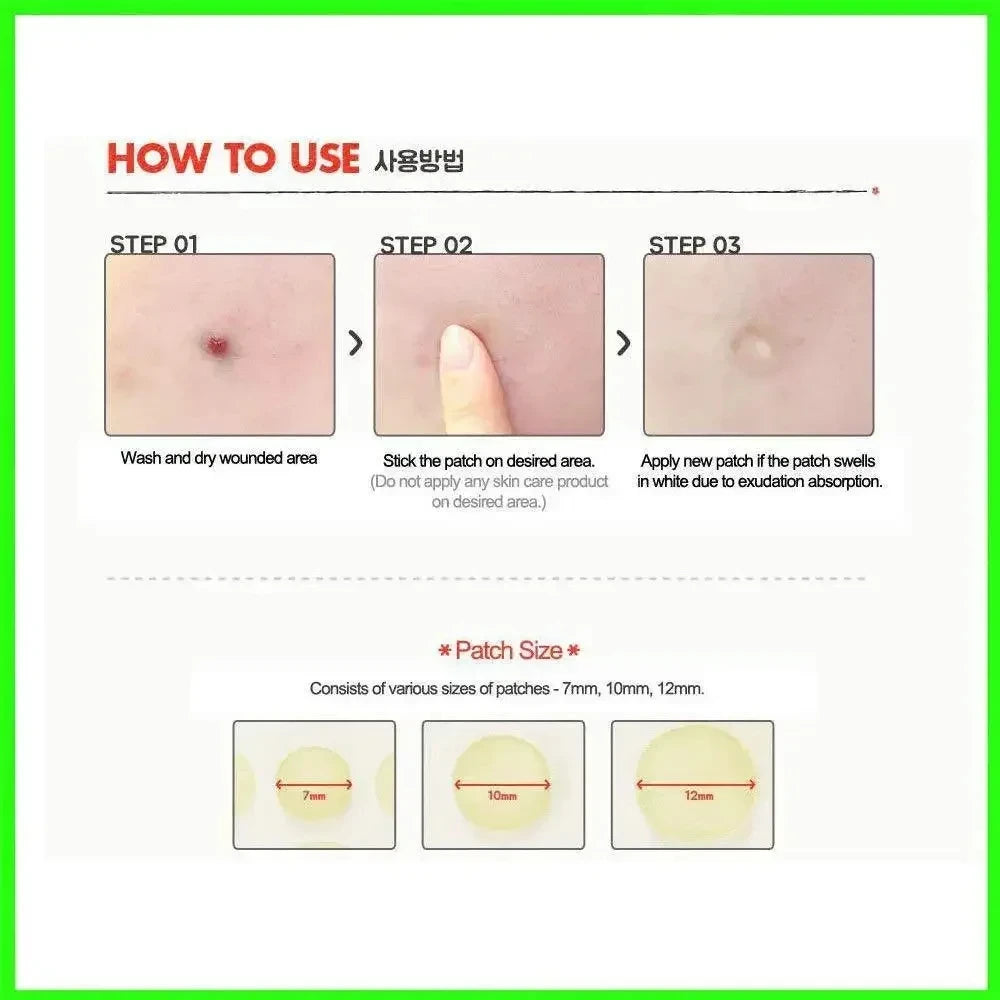 Overnight Acne Healing Patches
