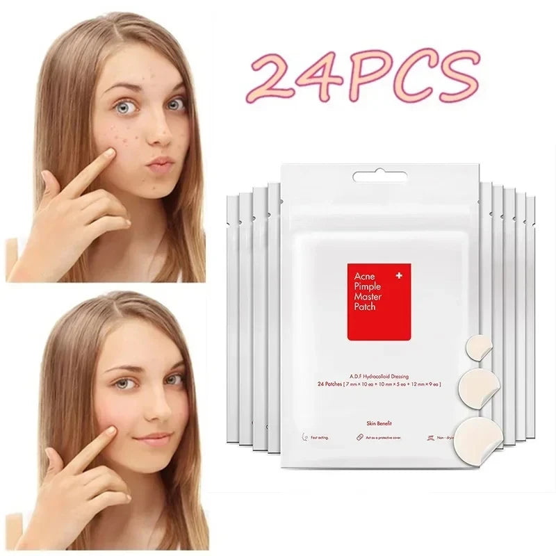 Overnight Acne Healing Patches