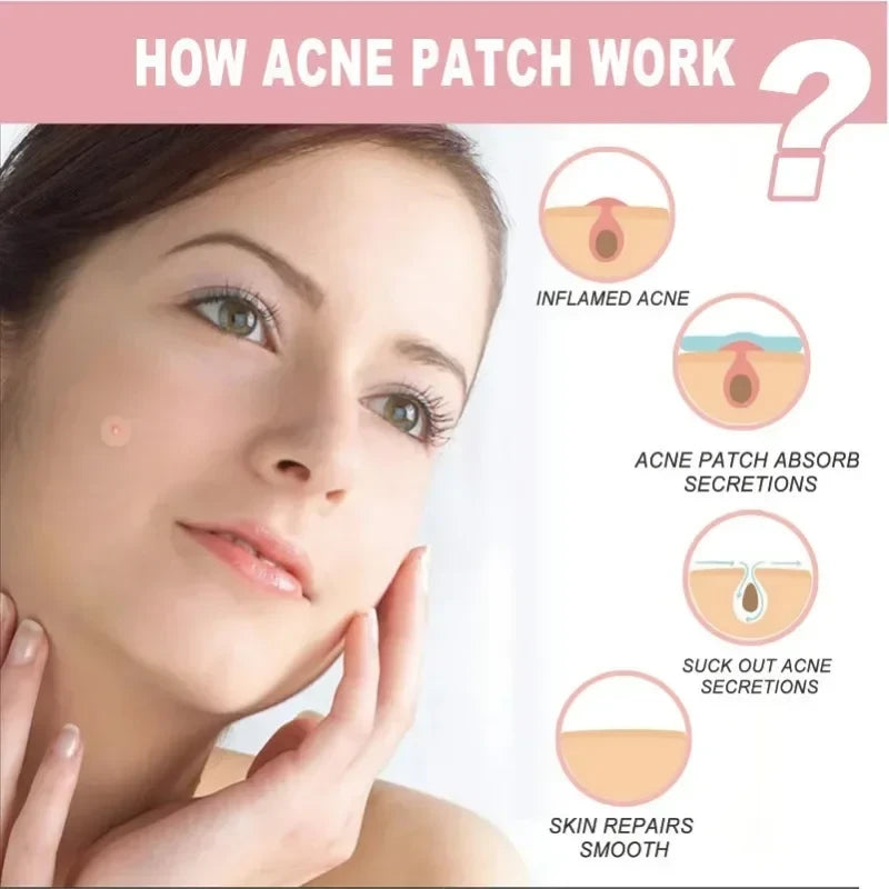 Invisible Hydrocolloid Acne Patches