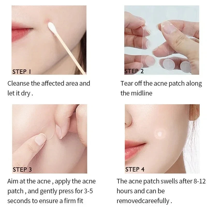 Invisible Hydrocolloid Acne Patches