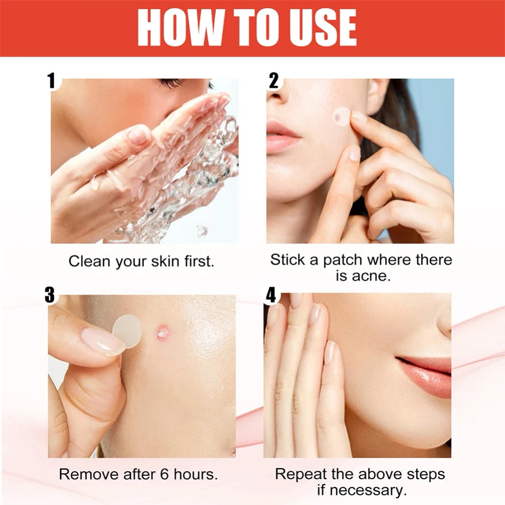 Invisible Acne Pimple Patches
