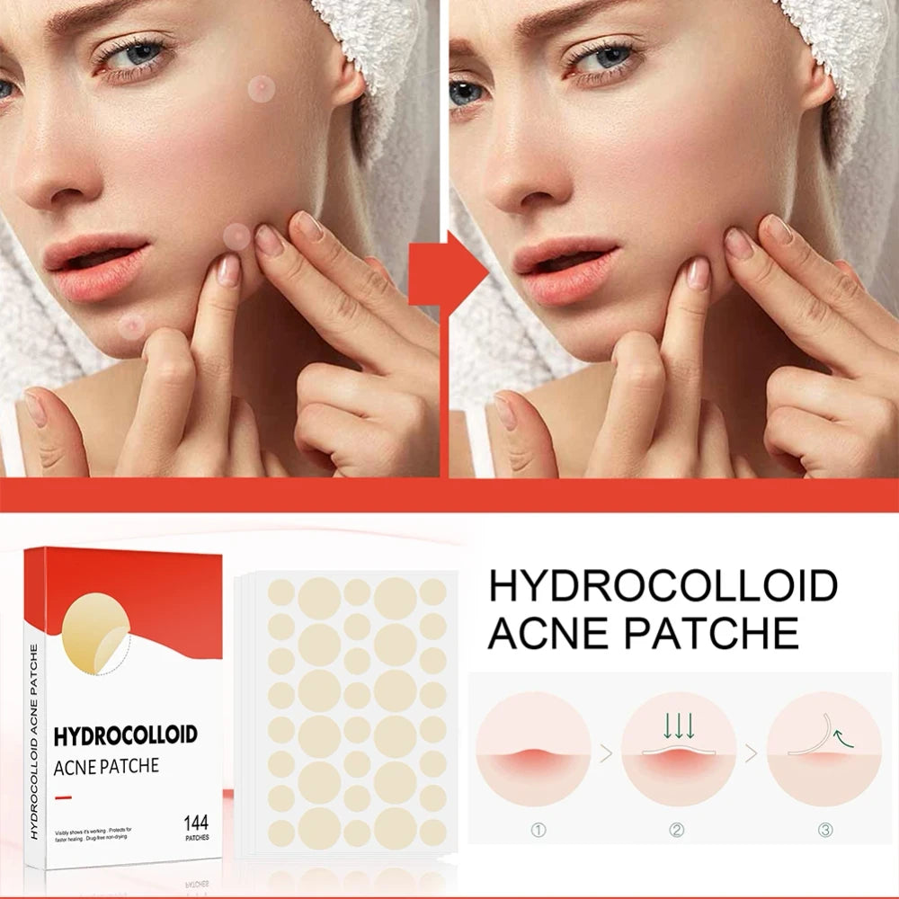 Invisible Acne Pimple Patches