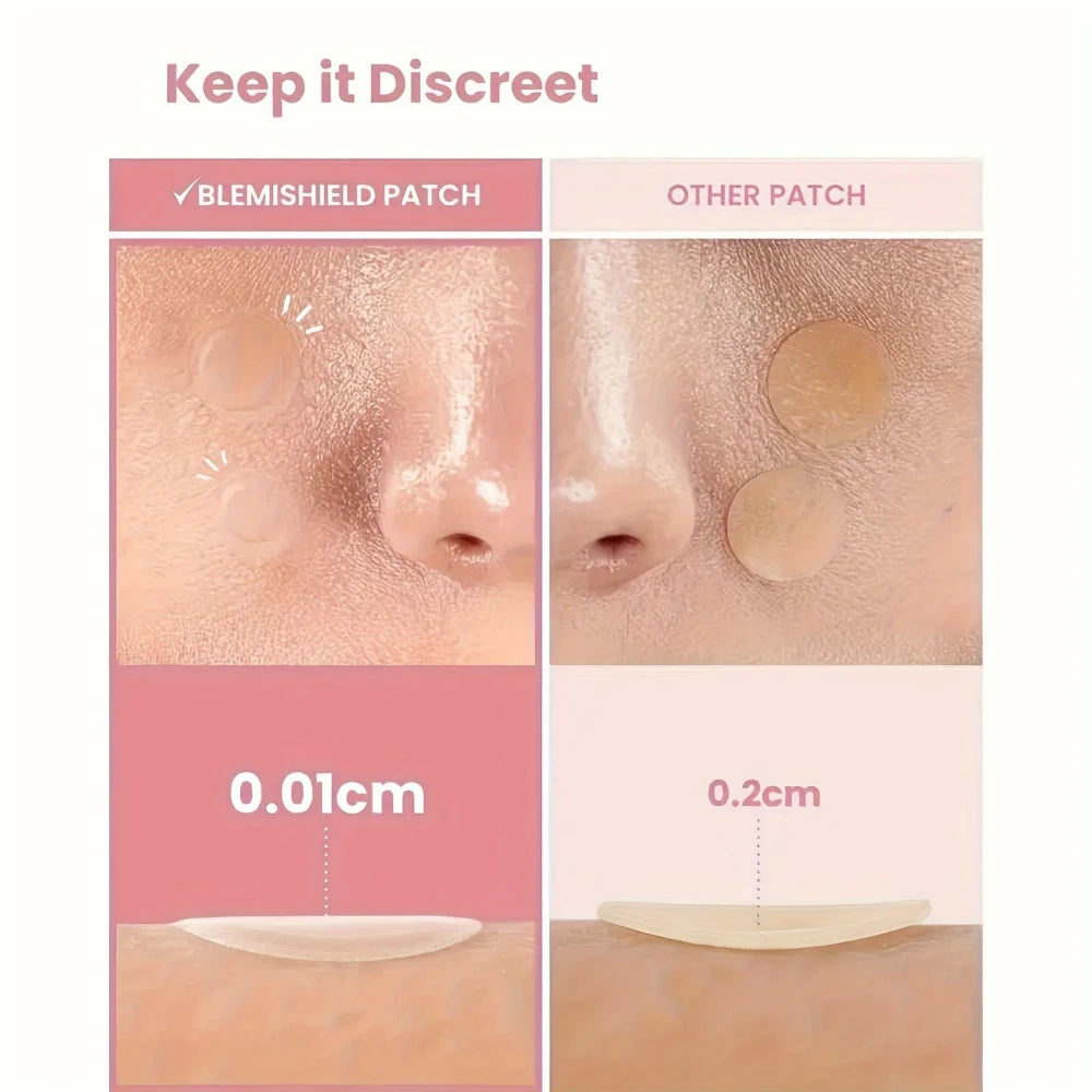 Hydrocolloid Acne Patches